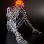 Traumatic Brain Injury